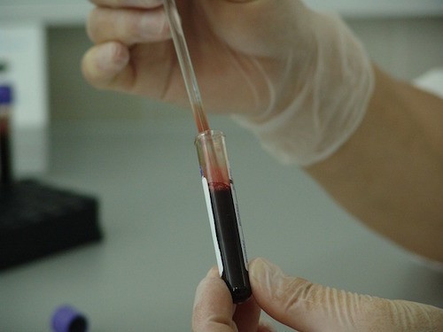 Новый тест крови спасает от ошибочного назначения антибиотиков